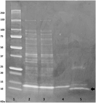 Buwchitin: A Ruminal Peptide with Antimicrobial Potential against Enterococcus faecalis